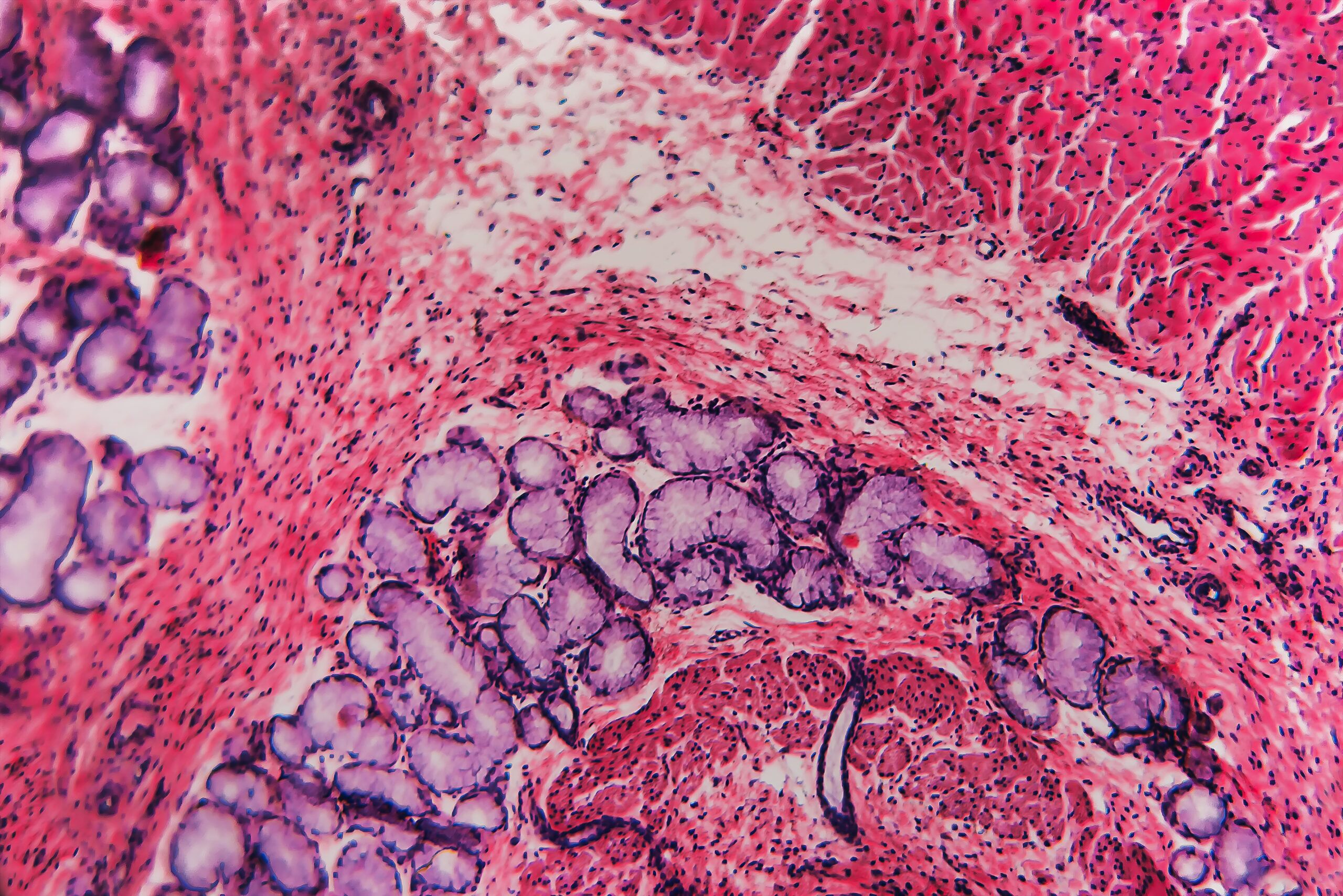 Gastrointestinal cancer in dogs Lab image showing GI cancer deterioration