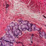 Gastrointestinal cancer in dogs Lab image showing GI cancer deterioration