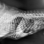 Liver Disease in Dogs